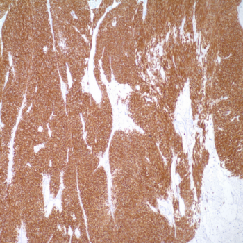Кролячі моноклональні антитіла до CD117/c-kit YR145; 7 мл (117R-18), ГДВ ANT-117R фото